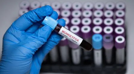 Moçambique com 11 casos suspeitos de Mpox além de três confirmados