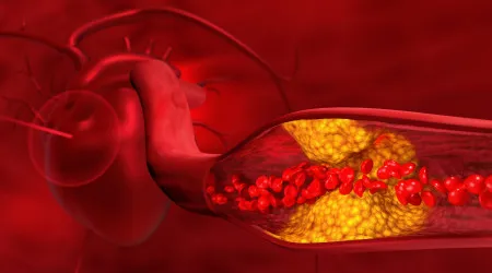 Quatro dicas para reduzir o colesterol de forma eficaz