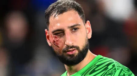 'Marca de guerra'. Assim ficou o rosto de Donnarumma após dura entrada