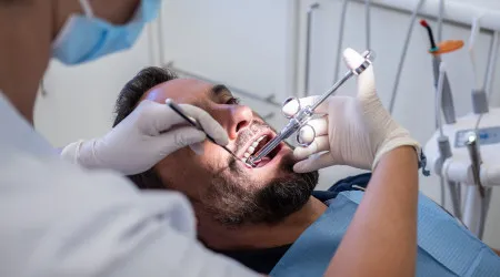 Há mais dentistas, mas 10% dos portugueses estão "sem acesso a cuidados"