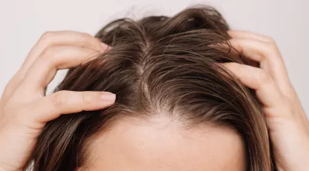 Já experimentou o óleo de cabelo tendência? 