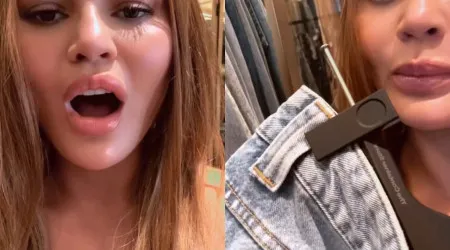 "Pior olho negro de sempre". O acidente de moda de Chrissy Teigen