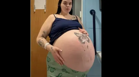 Uma 'penthouse'? Grávida com barriga 'gigante' explica condição rara