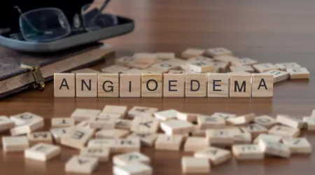 Angioedema Hereditário. A doença rara que pode levar à morte por asfixia