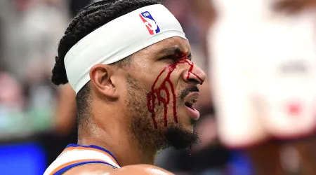 Jogador dos New York Knicks ficou com a cara neste estado após cotovelada