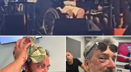 Herman José caiu, Eduardo Madeira com cabeça aberta e Markl de olho negro