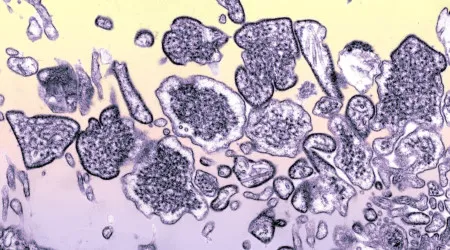 Descoberto nanocorpo capaz de neutralizar os vírus mortais Hendra e Nipah