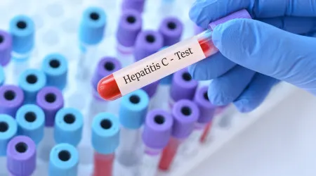 Novo estudo observa ligação entre o vírus da hepatite C e a esquizofrenia
