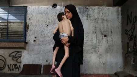 Um quarto das crianças dos 6 meses aos 5 anos em Gaza está subnutrida