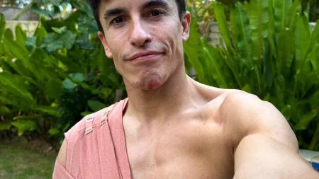 Marc Márquez saiu do GP da Indonésia com possível fratura na clavícula