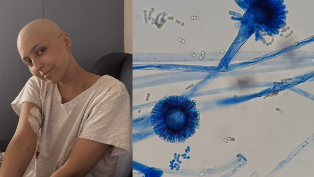 Aspergilose invasiva: O problema que afeta jovem que fez apelo emotivo