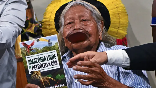 
                    Cacique indígena Raoni Metuktire submetido a intervenção cirúrgica
                
