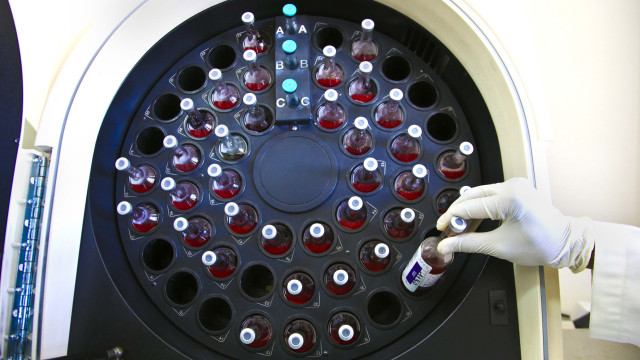Portugal com aumento de casos de hepatite A associados a surtos em 2025