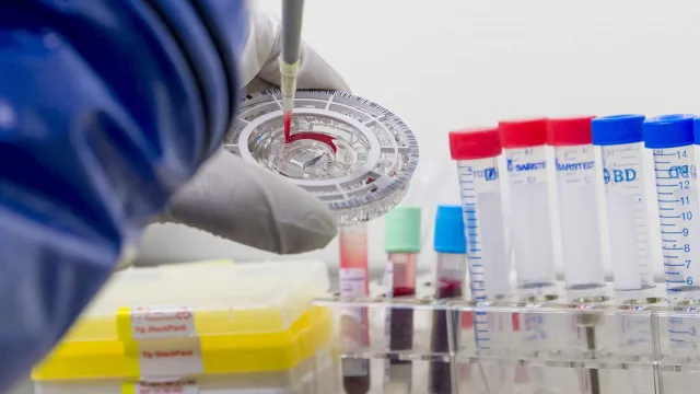 
                    Confirmado primeiro caso de Ébola em Goma no leste da RDCongo
                