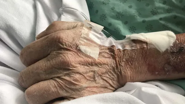 Idoso dado como morto no hospital chega a funerária com sinais de vida