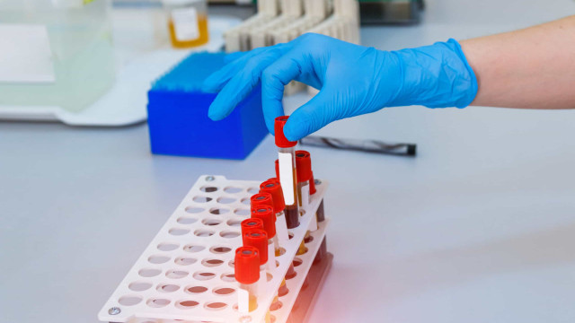 Exames que salvam vidas, mas você provavelmente nunca fez