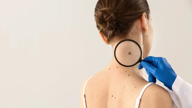 
                    Farmacêuticas anunciam resultados positivos para vacina contra melanoma
                