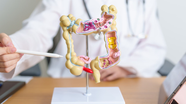 Câncer colorretal, como o de Preta Gil, cresce entre pessoas com menos de 50 anos