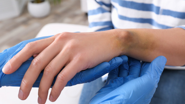 Médico sensibiliza: Leucemia pode ver-se nas mãos (e não é alarmismo)