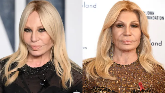 Fotos. Donatella Versace fez mudança no rosto?