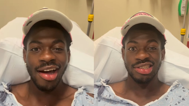 Lil Nas X hospitalizado após ficar com parte do rosto paralisado