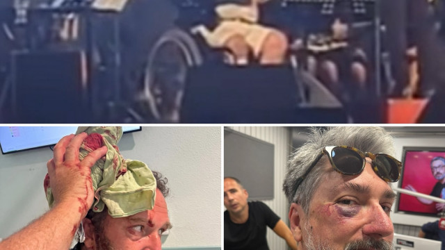 Herman José caiu, Eduardo Madeira com cabeça aberta e Markl de olho negro