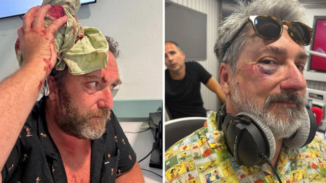 Herman José e a hilariante interação com o ChatGPT: "O meu melhor amigo" 3 Herman José caiu, Eduardo Madeira com cabeça aberta e Markl de olho negro