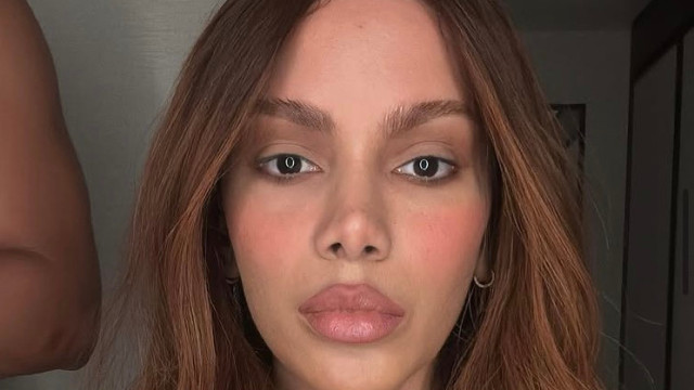 Se quiser o Smigle ou o Fofão, eu viro', diz Anitta sobre procedimento no rosto
