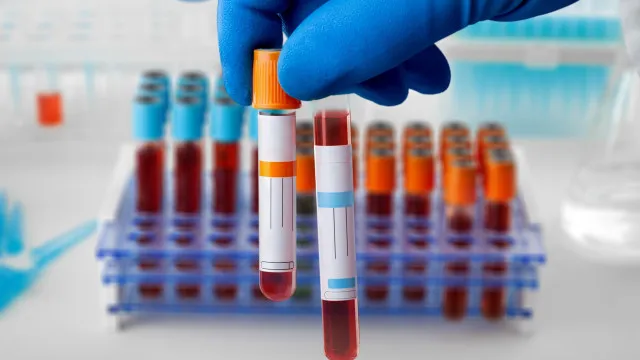 
                    PJ detém técnico de sangue por suspeitas de contaminação. IPST denunciou
                