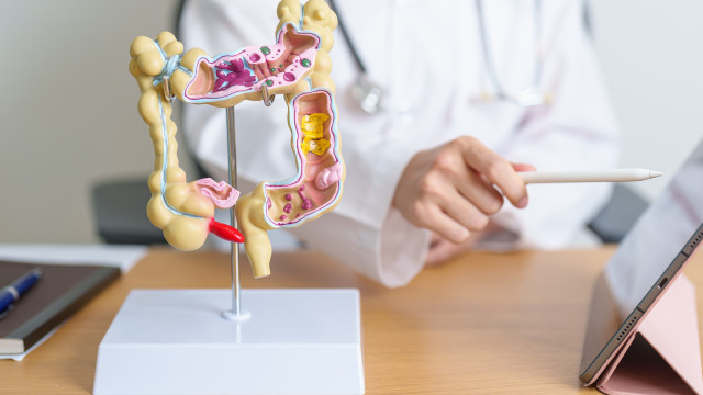Medicamento comum mostra resultados promissores contra câncer colorretal