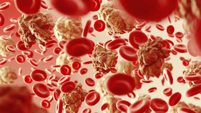 Mitos e verdades sobre cancros do sangue. Falámos com um médico