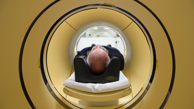 Brasil chega a 140 casos confirmados de mpox em 2026 2 Alzheimer é a segunda doença mais temida pelos brasileiros, atrás apenas do câncer