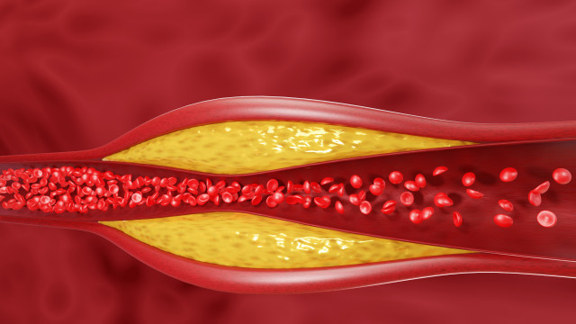 A pequena especiaria que pode ser a solução contra o colesterol alto
