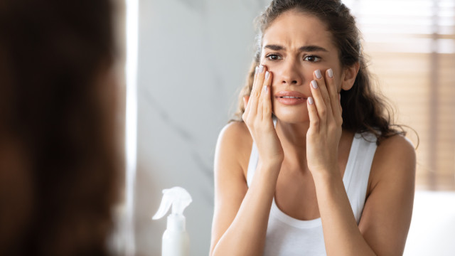 Será que tenho a pele oleosa por causa do óleo das batatas? Eis a razão