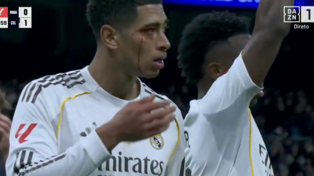 Bellingham sangra após cotovelada e leva cartão ao voltar sem autorização