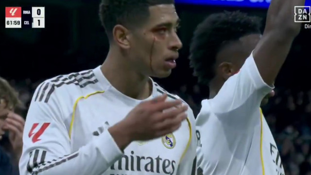 Bellingham ficou a sangrar, fez o que não devia e ainda recebeu cartão