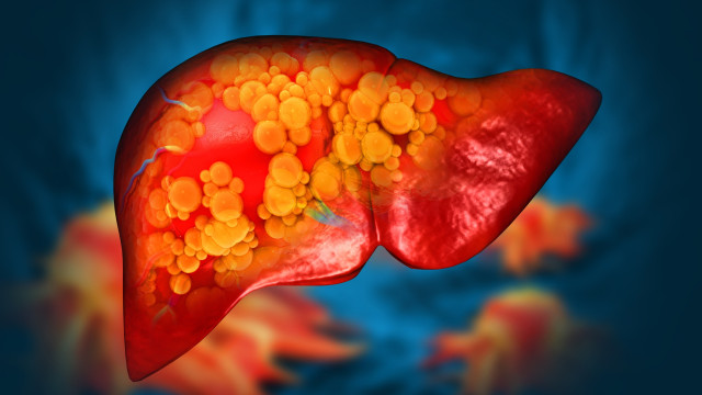 Cancro do fígado: Uma dieta rica em gordura aumenta o risco