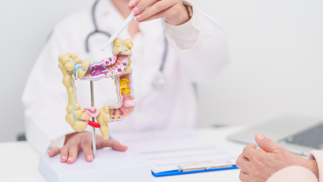 Hábitos diários que podem ajudar a reduzir o risco de câncer colorretal