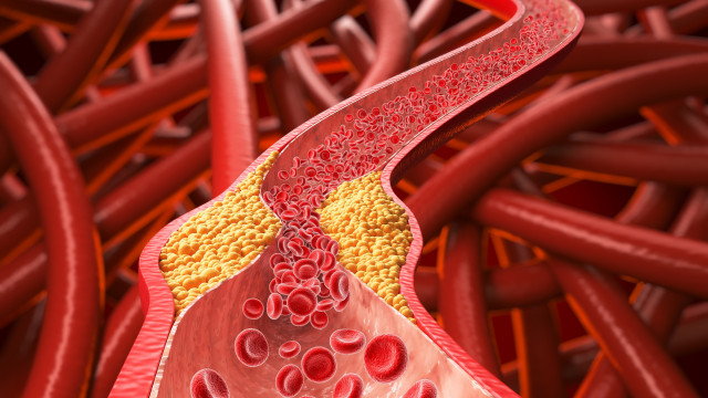 Alimento comum pode ajudar a derrubar o colesterol “ruim”