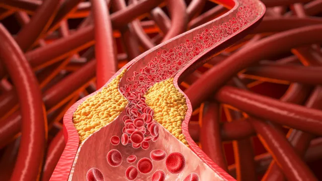 
                    Este alimento é um dos maiores aliados contra o colesterol, diz estudo
                
