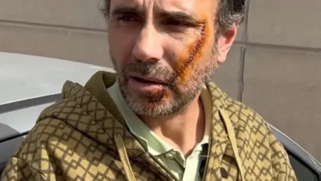 
                    Português esfaqueado em Espanha por cadastrado. Ficou desfigurado
                