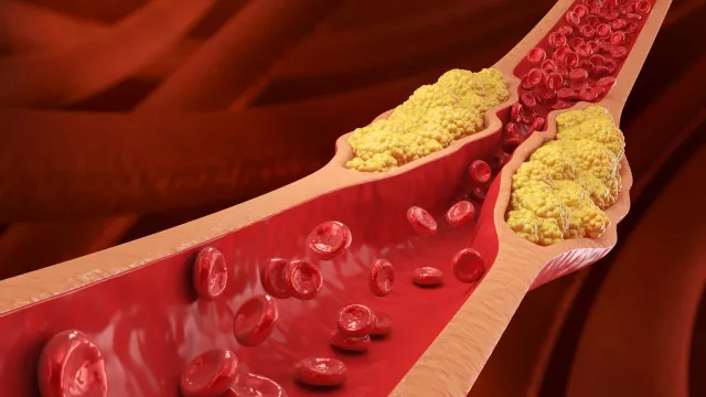 
                    5 hábitos que podem reduzir o colesterol de forma eficaz
                