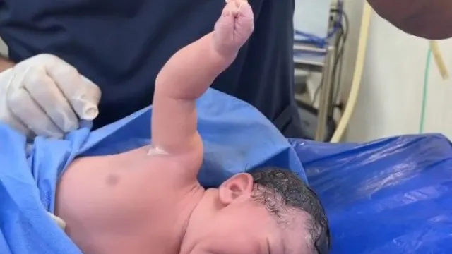 Recém-nascido não larga médico e momento torna-se viral. Ora veja