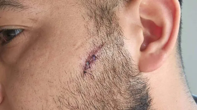 
                    Lisboa. Jovens agridem refugiado iraquiano com 