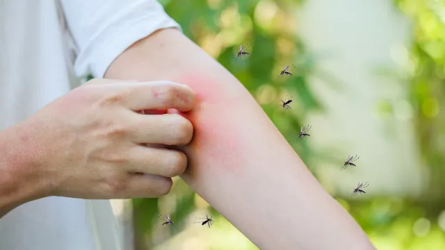 
                    Porque é que as melgas picam mais umas pessoas do que outras?
                
