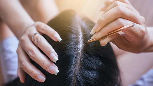 
                    Arrancar um cabelo branco faz com que cresçam mais? A explicação
                