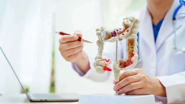 
                    Risco de cancro colorretal pode aumentar com estes alimentos comuns 
                
