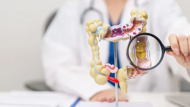 Comida a evitar para reduzir risco de cancro do cÃ³lon. Palavra de mÃ©dico