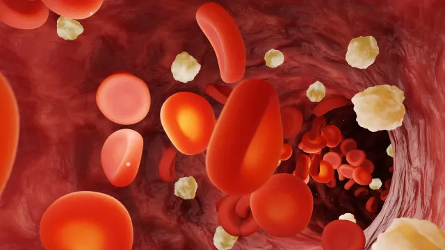 FaÃ§a estas 7 coisas de manhÃ£ para manter o aÃ§Ãºcar no sangue sob controlo