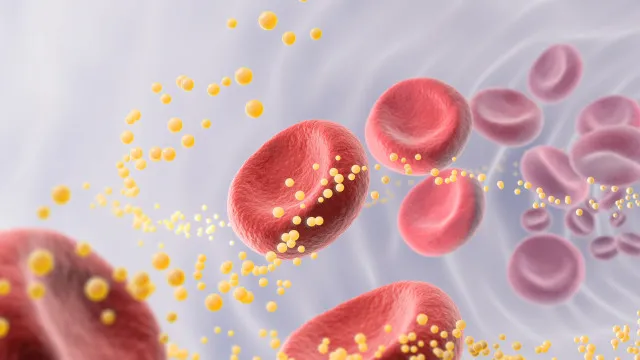 
                    3 hábitos diários que podem estar a aumentar os seus níveis de colesterol
                
